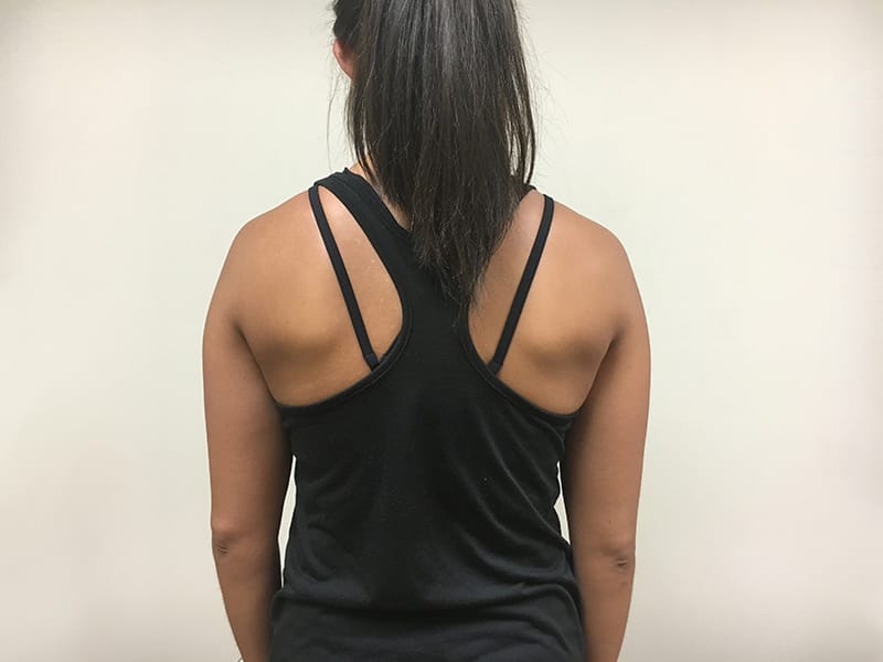 Shoulder blade squeeze start