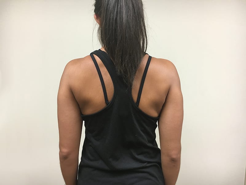 Shoulder blade squeeze end